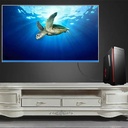 Anbear Display Port cable 6ft